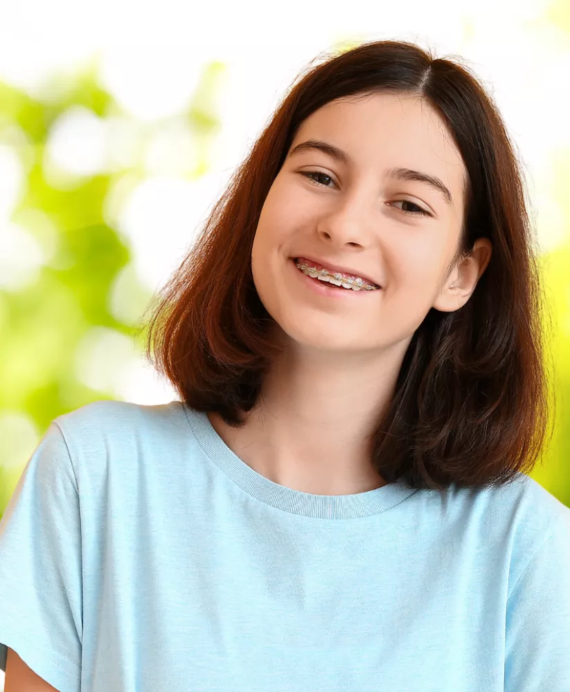 Ceramic Braces