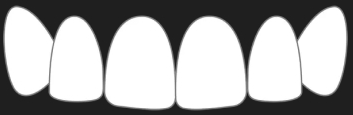 Smile Makeover
