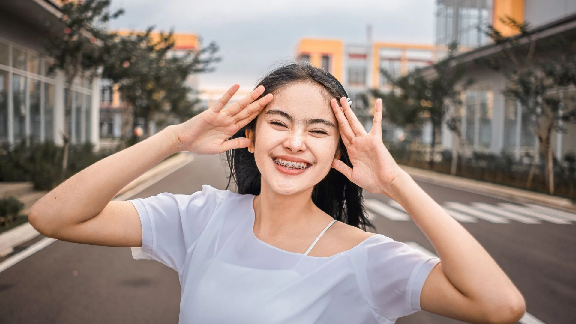 Types of Braces for Teeth: A Comprehensive Guide to Braces