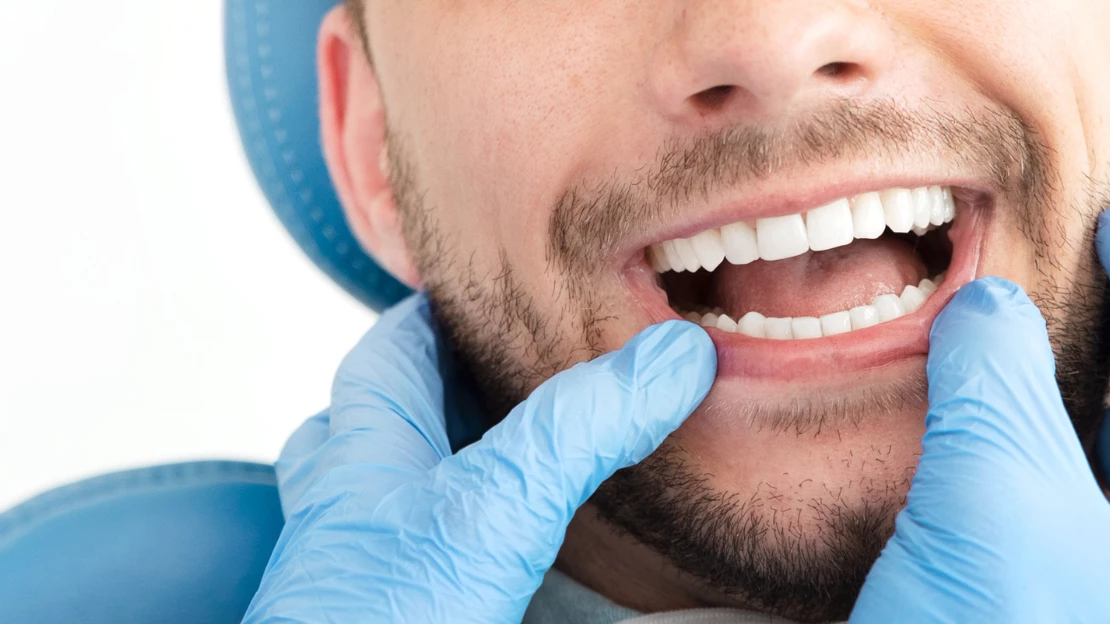 Braces for Teens: Strong Results During the Best Years to Get Them